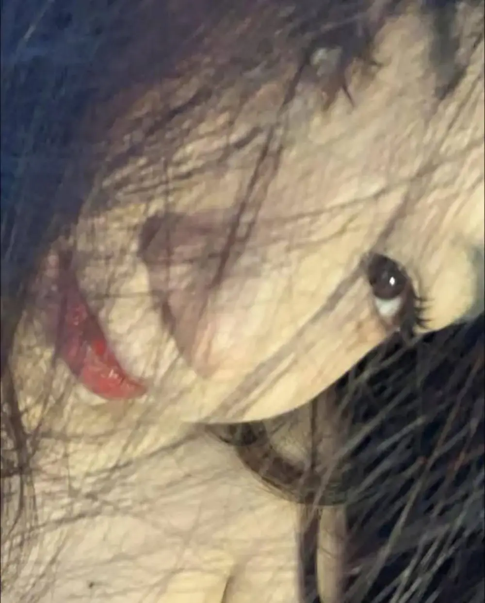 Besa4_